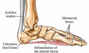 Stem Cell Treatment for Foot Pain: Learn the Truth.