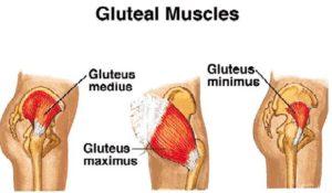 Gluteus Medius Pain: Is This the Cause of Your Butt Pain?