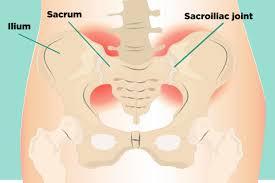 Rarely do i see people exercise that muscle group and for good reason. Sacroiliac Si Joint Pain Understanding Causes Symptoms Treatment