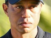 Tiger Woods Surgery with ‘multiple Injuries’ After Rollover Accident Near