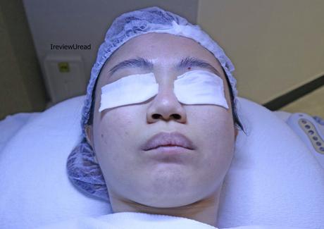 IDS Aesthetics Facial Treatment Review