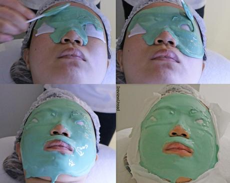 IDS Aesthetics Facial Treatment Review