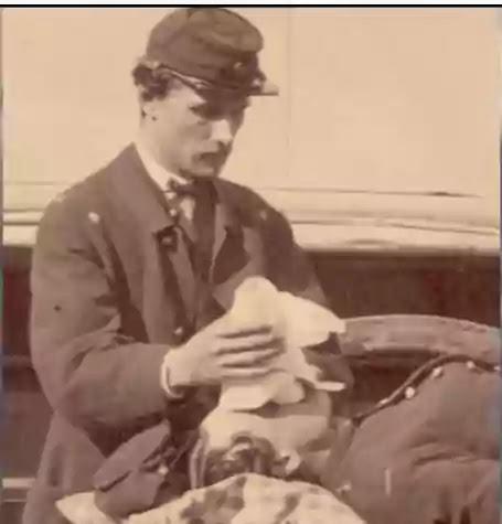 Amputations were Done Without Anesthesia_3 Amputations were Done Without Anesthesia_3