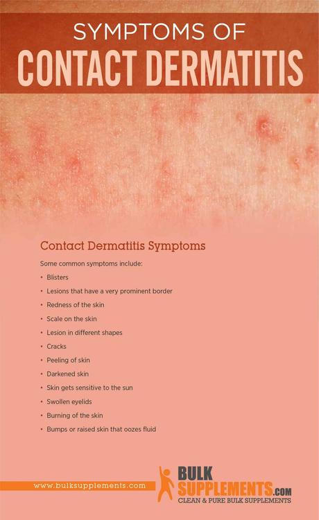 Contact Dermatitis Symptoms