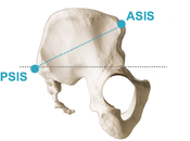 Psis Asis Tsic Wtic Positions Pelvis Well Download Scientific Diagram Some Published Here Because They Restricted Sensitive.