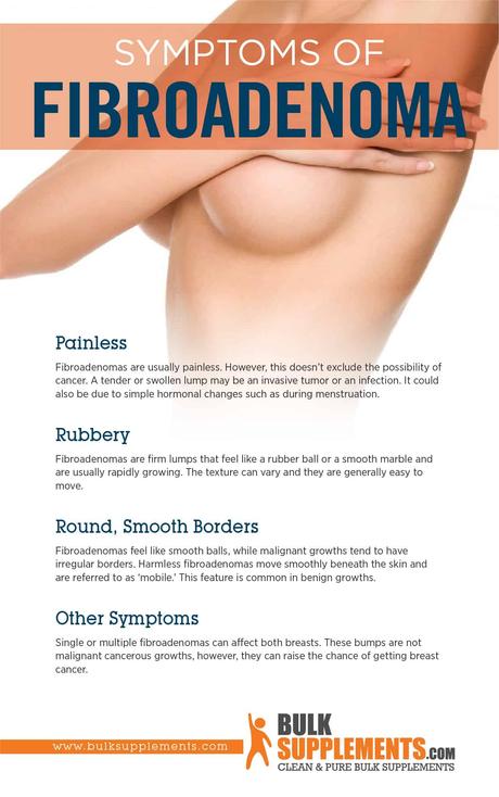 Fibroadenoma Symptoms