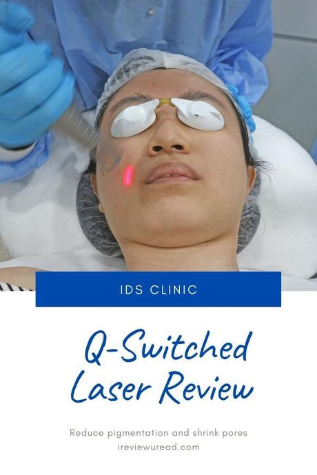 How I Reduce Pigmentation with Q Switch Laser Treatment | IDS Clinic