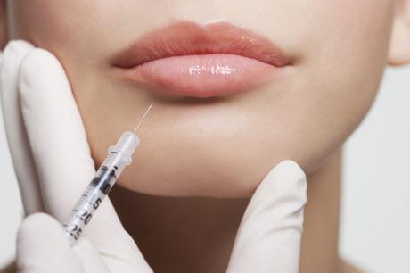 What Should You Know Before Getting Fillers In Your Lips?