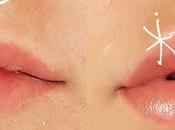 What Should Know Before Getting Fillers Your Lips?