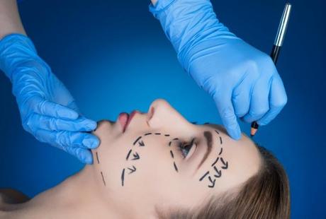 What is a Facelift? Should You Go For It?
