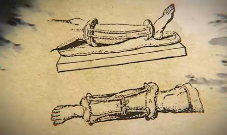 What Surgery Was Like In Ancient Egypt