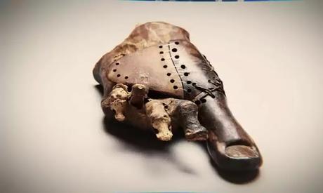 Prosthetics and Circumcision