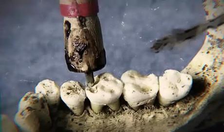 ancient egypt dental surgery