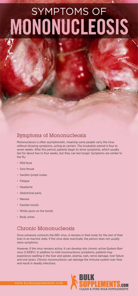 Mononucleosis Symptoms