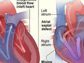 What Congenital Heart Defects Might Family Women Suffer From?