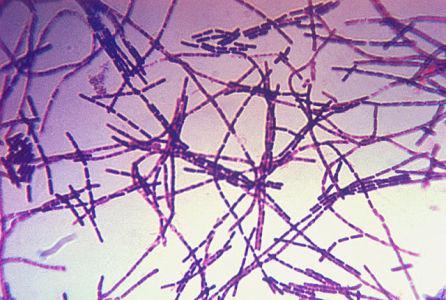 Bacillus Anthracis (Public Domain Image)