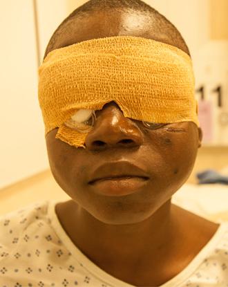 “HelpMeSee” in the face of Cataract Blindness