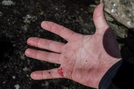 hand with dirt and blood on it