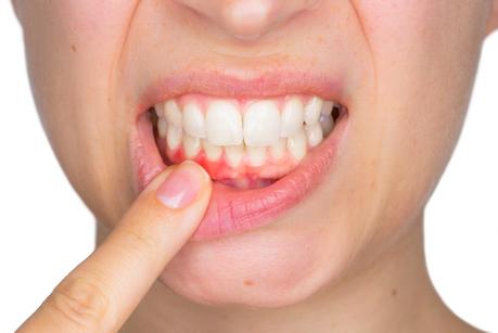 6 Common Dental Problems And What To Do About Them