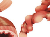 Bronchial Asthma (Tamaka Shwasa)