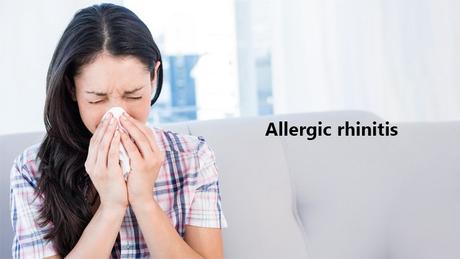 RHINITIS (PRATISHYEYA) RHINITIS (PRATISHYEYA)