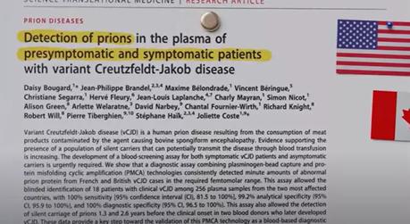 vCJD vCJD