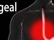 Gastro-esophageal Reflux Disorder {acid Reflux}