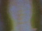 Late Aster: Dichotomy