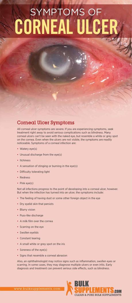 Corneal Ulcer: Characteristics, Causes & Treatment Corneal Ulcer Symptoms