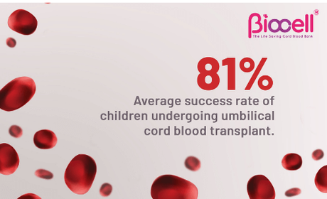 Preserving Umbilical Cord Blood Stem Cells – Why and How