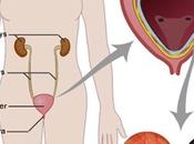 Cystitis Causes, Symptoms, Ayurvedic Treatment, Herbal Remedies