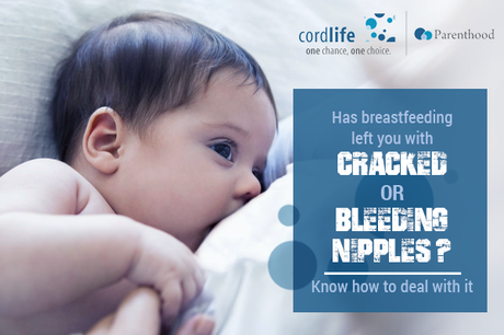 Has breastfeeding left you with cracked or bleeding nipples? Know how to deal with it