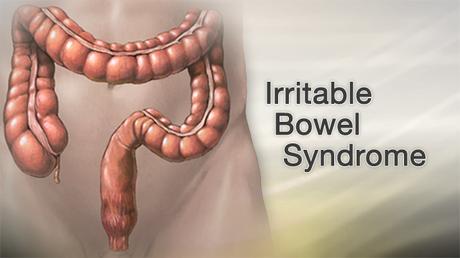 Herbal Remedies for Irritable Bowel Syndrome