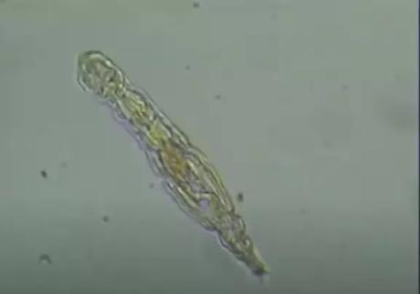 Tiny creatures called rotifers wake up after 24,000 years Tiny creatures called rotifers wake up after 24,000 years