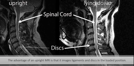 upright MRI vs lying down