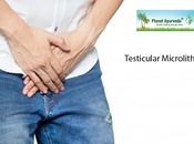 Ayurvedic Treatment Testicular Microlithiasis