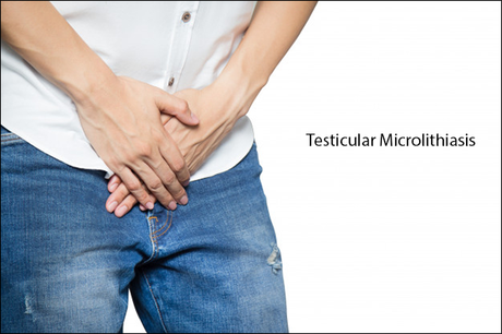 Ayurvedic Treatment for Testicular Microlithiasis