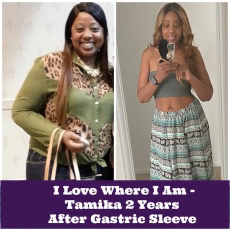 I love where I am – Tamika 2 Years After Gastric Sleeve