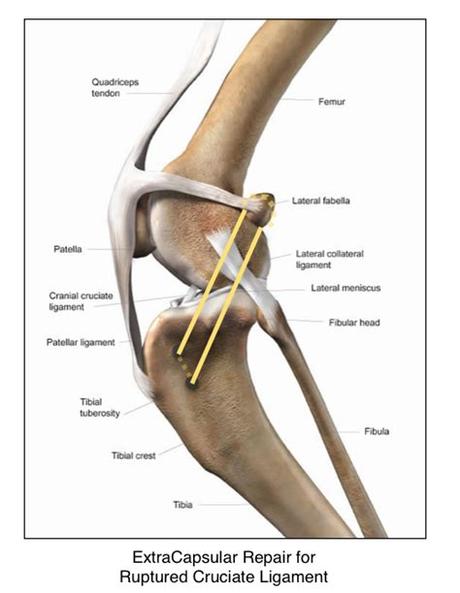 Left leg ligaments / ligaments are bands of tough elastic tissue around your joints. Knee Injuries: The Ruptured Anterior Cruciate Ligament ...
