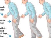 Herbal Remedies Parkinson’s Disease