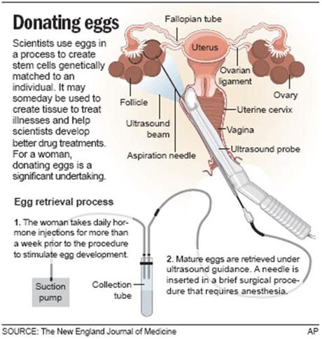 Egg donor america includes this range in all estimates for future parents to consider when determining their egg donor requirements. How much money does an egg donor make, buy venosan ...