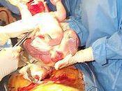 Baby Lungs Unexpected Birth Story