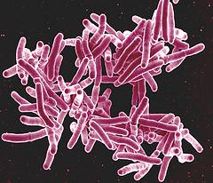 Rates of Drug Resistant Tuberculosis on the Rise