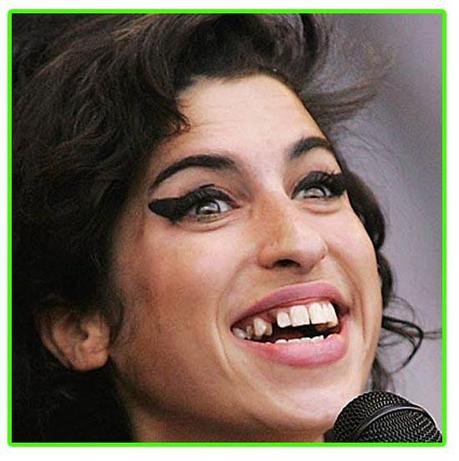 Terrible Pictures of Amy Winehouse Drunk, Tweeking, Stoned, and/or Anorexic