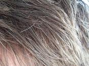 Hair Turns Gray