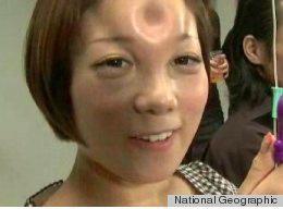 Bagel Heads: Japan’s New Body Modification Trend