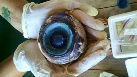 Mysterious Giant Eyeball Washes Ashore at Pompano Beach, FL