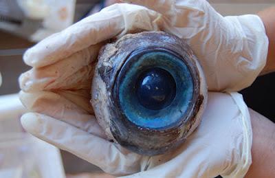 Whose Eyeball Is This?