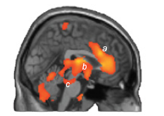 Brain correlates of switching consciousness on and off again