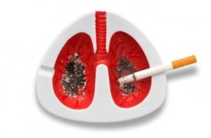 Lung cancer Types Causes Symptoms 300x197 Lung Cancer   Types, Causes & Symptoms